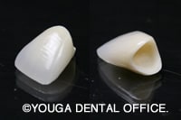 オールセラミッククラウン