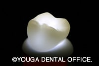 ジルコニアクラウン