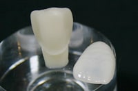 ラミネートベニア2