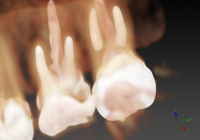 CTによる精密な診査・診断