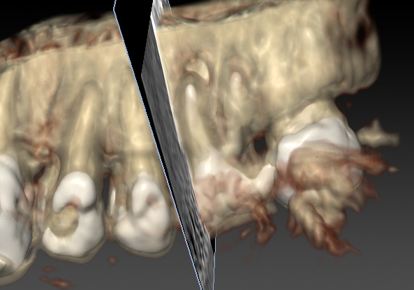 CTによる精密な診査・診断