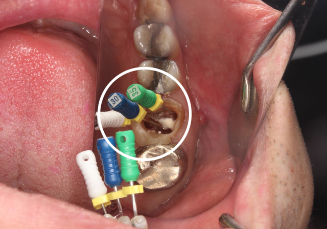 当院での実症例・治療の流れ