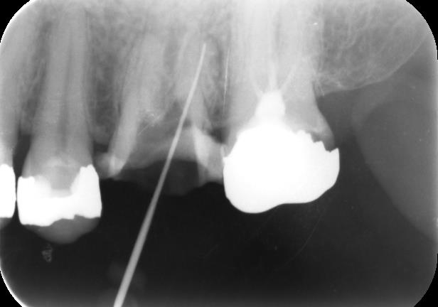 当院での実症例・治療の流れ