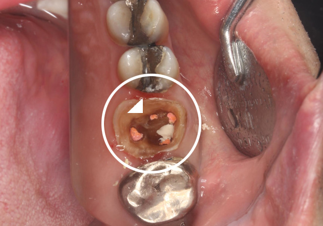 当院での実症例・治療の流れ