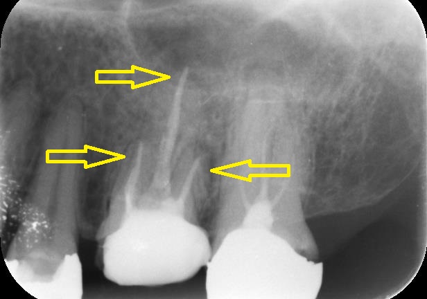 当院での実症例・治療の流れ