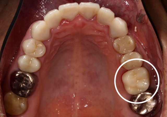 当院での実症例・治療の流れ