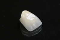 理由6．技工物のクオリティ（技工士紹介）