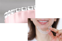 様々な矯正治療法