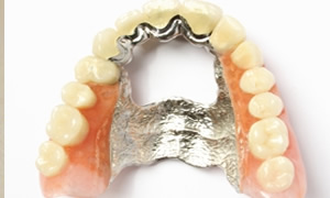 入れ歯・部分入れ歯