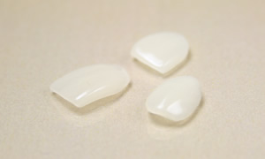 ラミネートベニア